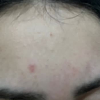 Yves Rocher Ürünleri Cildimi Mahvetti