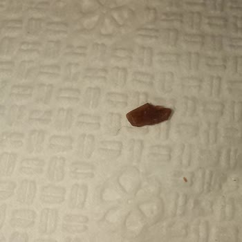 BİM'den Aldığım Gofrette Plastik Parça Şoku!