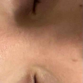 Yves Rocher Ürünleri Cildimi Mahvetti: Para İadesi Talep Ediyorum