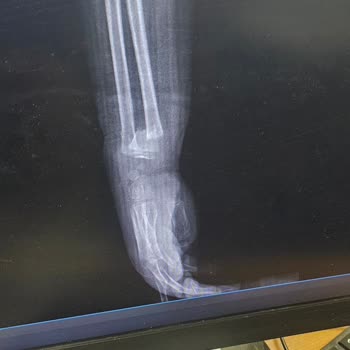 Ş. J. Yarbay Yusuf Turgut İlkokulu Öğretmen Annenin Çocuğunun Şikayeti!