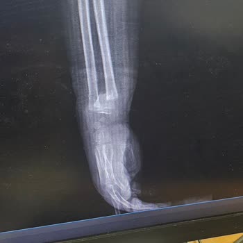 Ş. J. Yarbay Yusuf Turgut İlkokulu Öğretmen Annenin Çocuğunun Şikayeti!