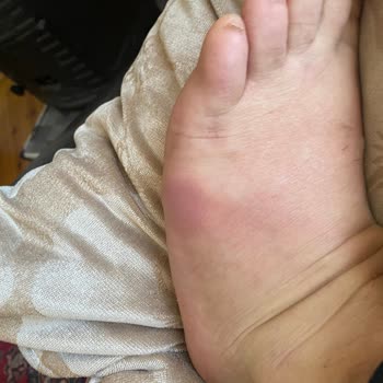 Ayakkabı Sorunu Ve Müşteri Hizmetlerinde Yaşanan Zorluklar