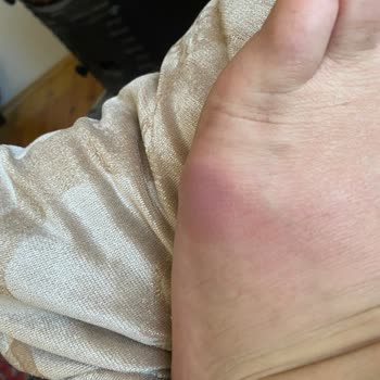 Ayakkabı Sorunu Ve Müşteri Hizmetlerinde Yaşanan Zorluklar