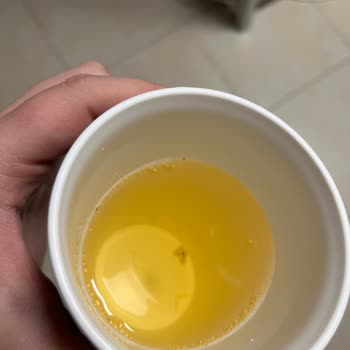 Beklenmedik Bir Ürün Sorunu