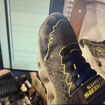 Skechers Ayakkabının Hızla Deforme Olması