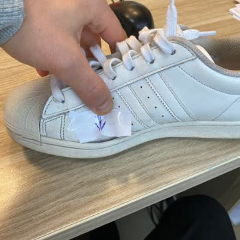 Adidas İade Sürecinde Hayal Kırıklığı
