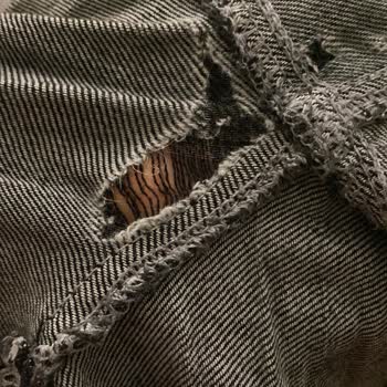 Kısa Sürede Yıpranan Kot Pantolon Ve Müşteri Hizmetleri Sorunu