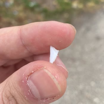 Çokonat Ürünü İçinden Çıkan Sert Cisim Tehlikesi