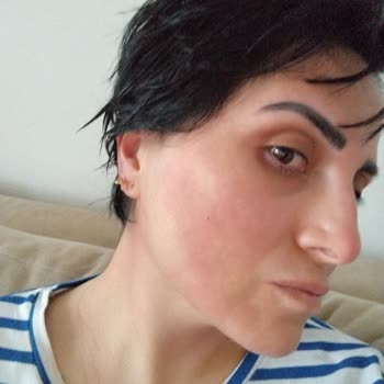 Sebamed Skincare Product Caused Severe Skin Burning