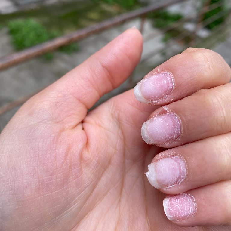 Güzellik Merkezinde Beklenmedik Deneyim Ve İlgisiz Hizmet