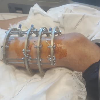 Hayal Kırıklığı Ve Mağduriyet: Başarısız Ameliyatlar Sonrası Zorlaşan Yaşam