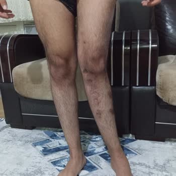 Eki aç