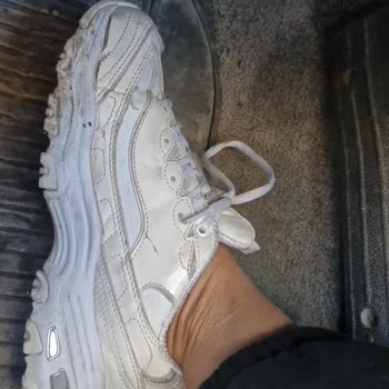 Skechers Ayakkabının Kalite Hayal Kırıklığı
