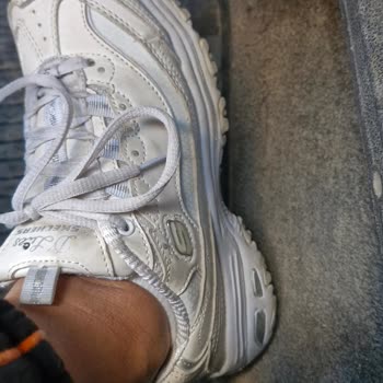 Skechers Ayakkabının Kalite Hayal Kırıklığı
