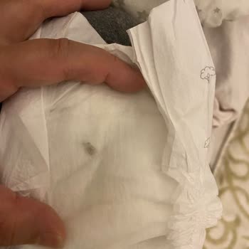 Bebek Bezinde Siyah Parça: Üretim Hatası Mı?