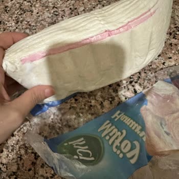 Bozuk Milföy Ve Eksik Para Üstü Sorunu