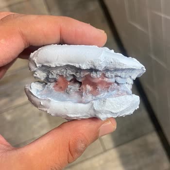 Dr. Serkan Sağır Geri Dönüşü Olmayacak Ameliyata Soktu