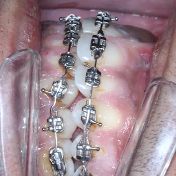 Dr. Serkan Sağır Geri Dönüşü Olmayacak Ameliyata Soktu