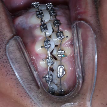 Dr. Serkan Sağır Geri Dönüşü Olmayacak Ameliyata Soktu