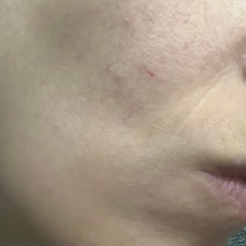 Kiehl's Ürünleri Cildimde Sorun Yarattı!