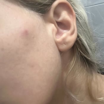 Kiehl's Ürünleri Cildimde Sorun Yarattı!