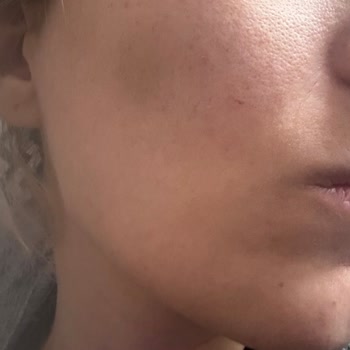Kiehl's Ürünleri Cildimde Sorun Yarattı!