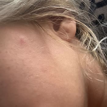 Kiehl's Ürünleri Cildimde Sorun Yarattı!