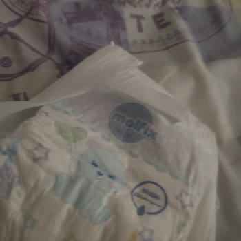 Molfix Bebek Bezinde Hasarlı Cırt Cırt Sorunu