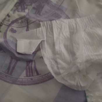 Molfix Bebek Bezinde Hasarlı Cırt Cırt Sorunu