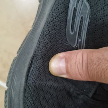 Skechers Ayakkabılarında Kalite Sorunu Ve İnceleme Süreci