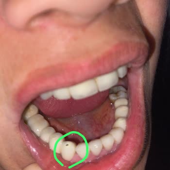 Dent Harmony Tecrübesiz Hekimler ve hatalı Uygulamalar!