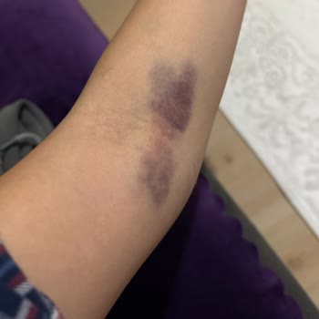 Kızılay Sağlık Grubu Kağıthane Kötü Deneyim: Hijyen Ve Profesyonellik Sorunları!