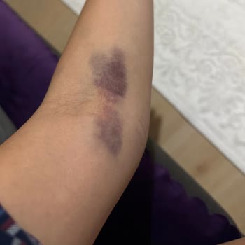 Kızılay Sağlık Grubu Kağıthane Kötü Deneyim: Hijyen Ve Profesyonellik Sorunları!