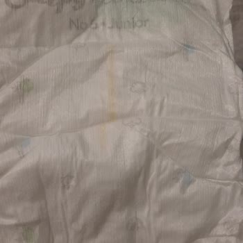 Sleepy Bio Naturel Bebek Bezinde Kalite Düşüşü Ve Sızdırma Sorunu