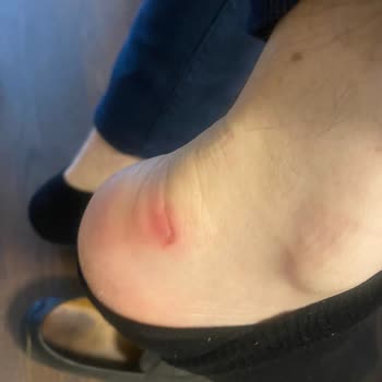 Yanlış Tamir Ve İade Süreci Mağduriyeti