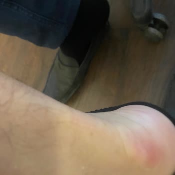 Yanlış Tamir Ve İade Süreci Mağduriyeti