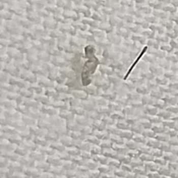 Görünmeyen Deri Sorunu Ve Çaresizliği