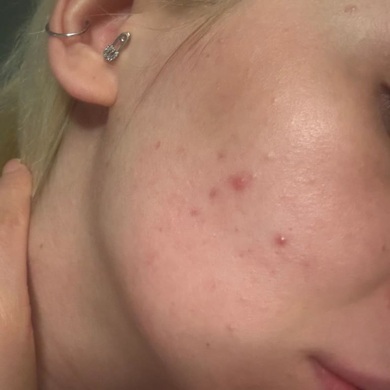 Sahte Ürün Kullanımı Ve Kötü Hizmet Deneyimi