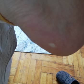 Kalitesiz Ayakkabı Deneyimi Ve Müşteri Hizmetleri Sorunu