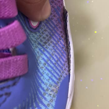 Skechers Ayakkabının Dayanıklılık Sorunu Ve Müşteri Hizmeti Eksikliği