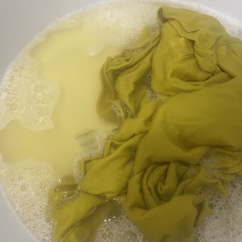 W Collection Renk Veren Ürün Kalite Sorunu Ve İade Süresi Yanılgısı