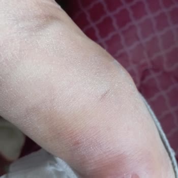 Derimod Bot: Ayak Sağlığını Tehdit Eden Deneyim