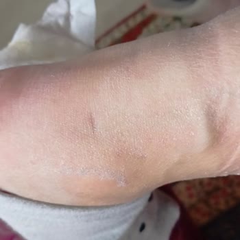 Derimod Bot: Ayak Sağlığını Tehdit Eden Deneyim