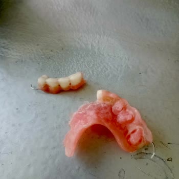 Protez Dişimin Tamiri Sırasında Yaşadığım Mağduriyet