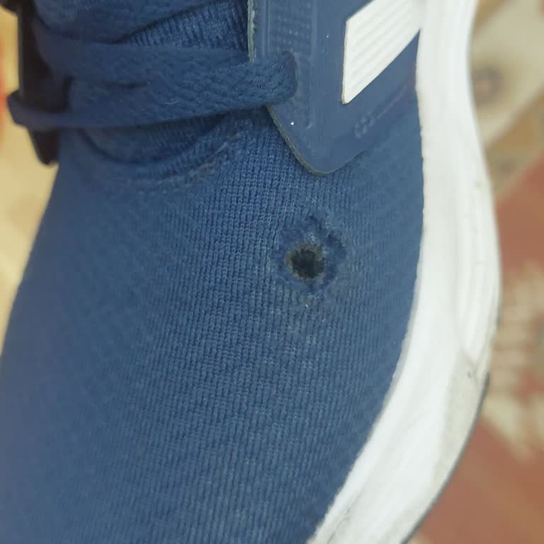 Adidas Ayakkabıda Beklenmedik Açılma Sorunu