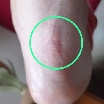 Asics Koşu Ayakkabılarıyla Yaşadığım Ağrılı Deneyim