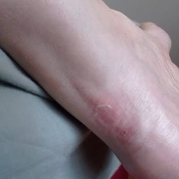 Asics Koşu Ayakkabılarıyla Yaşadığım Ağrılı Deneyim