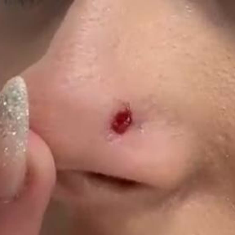 Moon Tattoo & Piercing / Tuğçe Ay Hatalı Piercing İşlemi!