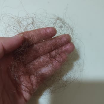 Yves Rocher Ürünleri Saç Dökülmesini Arttırdı