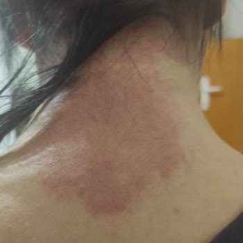 Gebelikte Güvenli Denilen Boya Kabusu